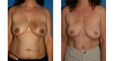 Photo of Patient 1
