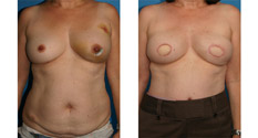 Photo of Patient 2