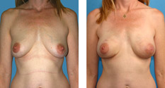 Photo of Patient 1