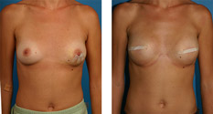 Photo of Patient 2