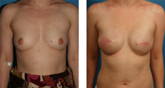 Photo of Patient 3